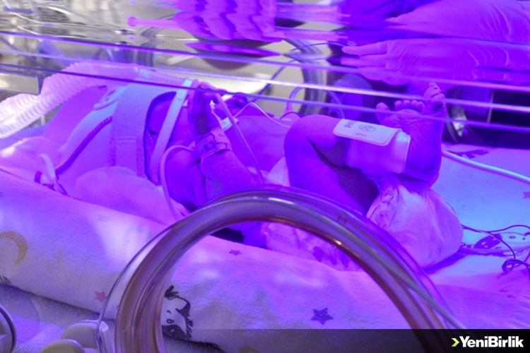 Prematüre bebekler düzenli takip edilmeyen hamilelikten doğuyor uyarısı