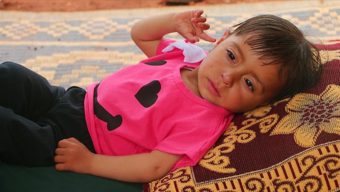 Suriyeli minik Aye'nin yaşaması acil ameliyata bağlı