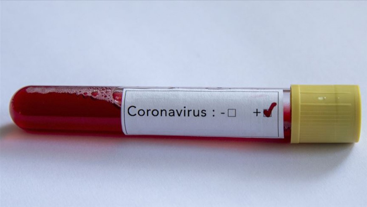 Sağlık çalışanı gelin ve damat düğünlerinde koronavirüse yakalandı