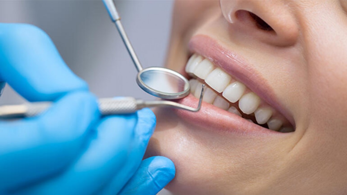 Diş Taşı Temizliği Nedir? Ne Kadar Sürede Bir Temizlik Gerekir?