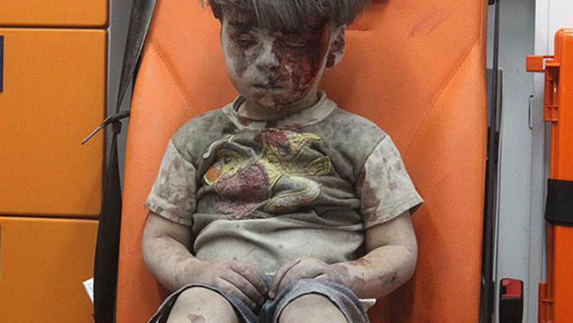 Halep'te Ümran gibi 100 binden fazla çocuk var