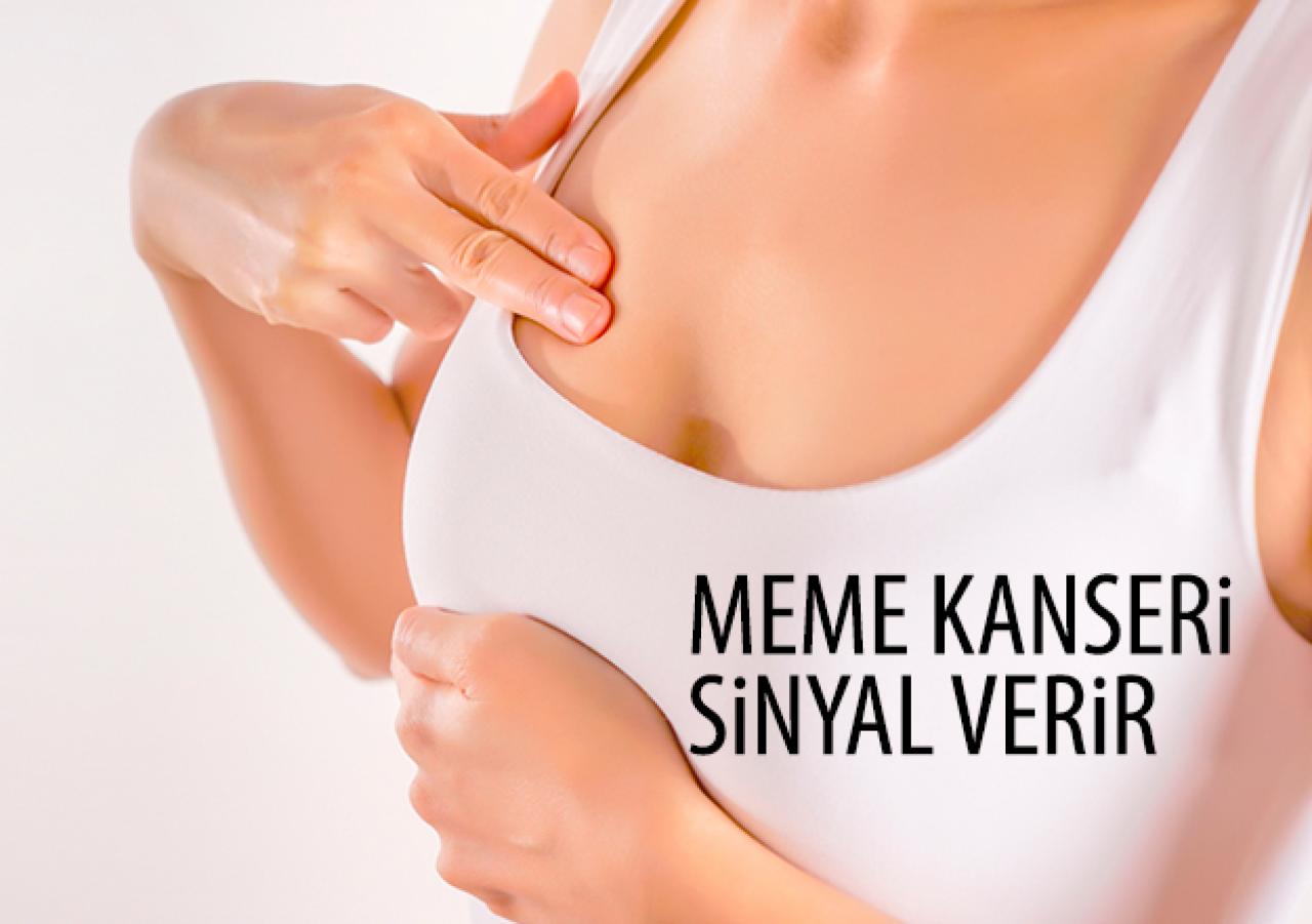 Meme kanseri sinyal verir