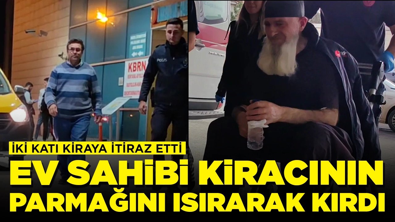 İki katı kirayı kabul etmedi: Kiracısını önce darp etti ardından parmağını ısırarak kırdı