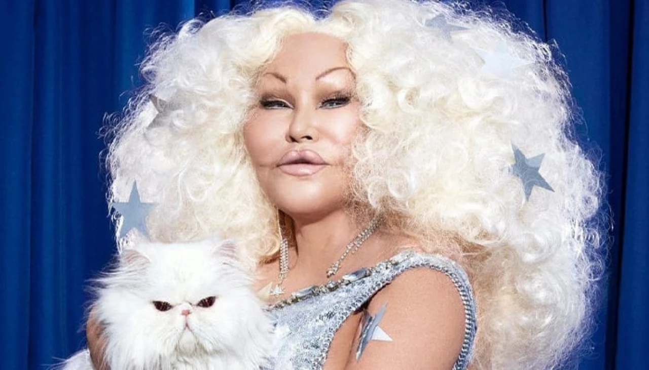 “Kedi Kadın” Jocelyn Wildenstein 84 Yaşında Hayatını Kaybetti!