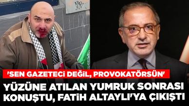 Yüzüne atılan yumruk sonrası konuştu, Fatih Altaylı'ya çıkıştı: 'Sen gazeteci değil, provokatörsün'