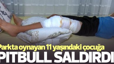 Bahçelievler'de parkta oynayan çocuğa pitbull saldırısı