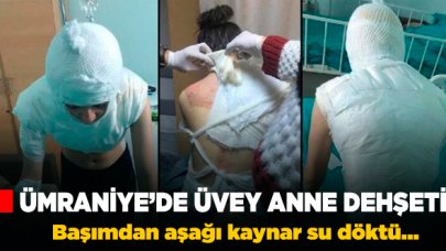 Üvey annesi dehşet yaşattı!