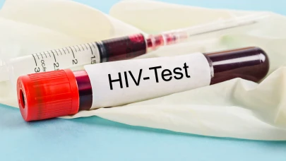 Kızılay’daki kanlarda HIV virüsü mi var?