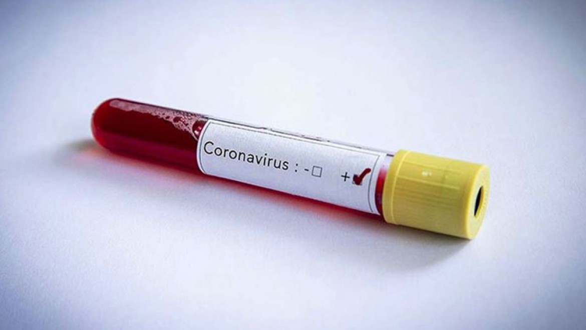 Koronavirüste ikinci dalga ihtimali en yüksek 10 ülke açıklandı