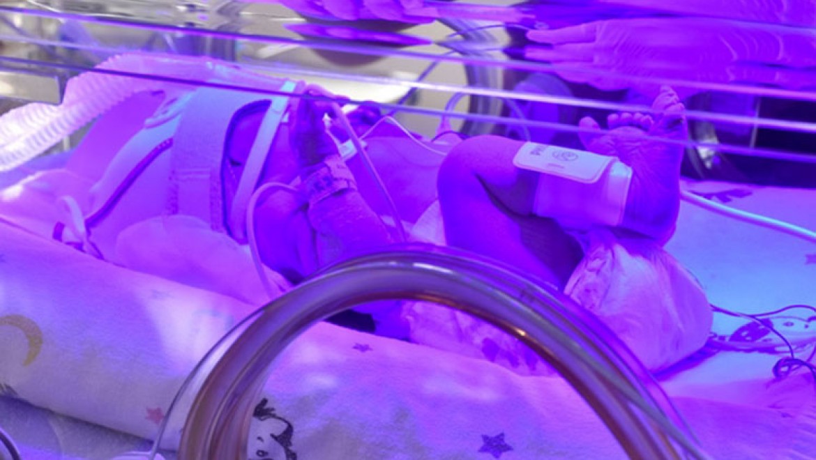 Prematüre bebekler düzenli takip edilmeyen hamilelikten doğuyor uyarısı