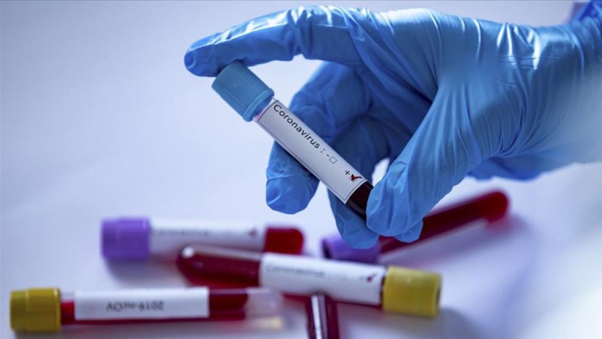 Bir Yargıtay üyesinin koronavirüs testi pozitif çıktı