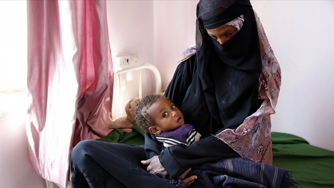 Yemen'de 10 milyon insan açlıkla burun buruna