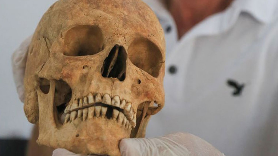 Euromos'ta '2 bin 200 yıllık beyin ameliyatı' izleri