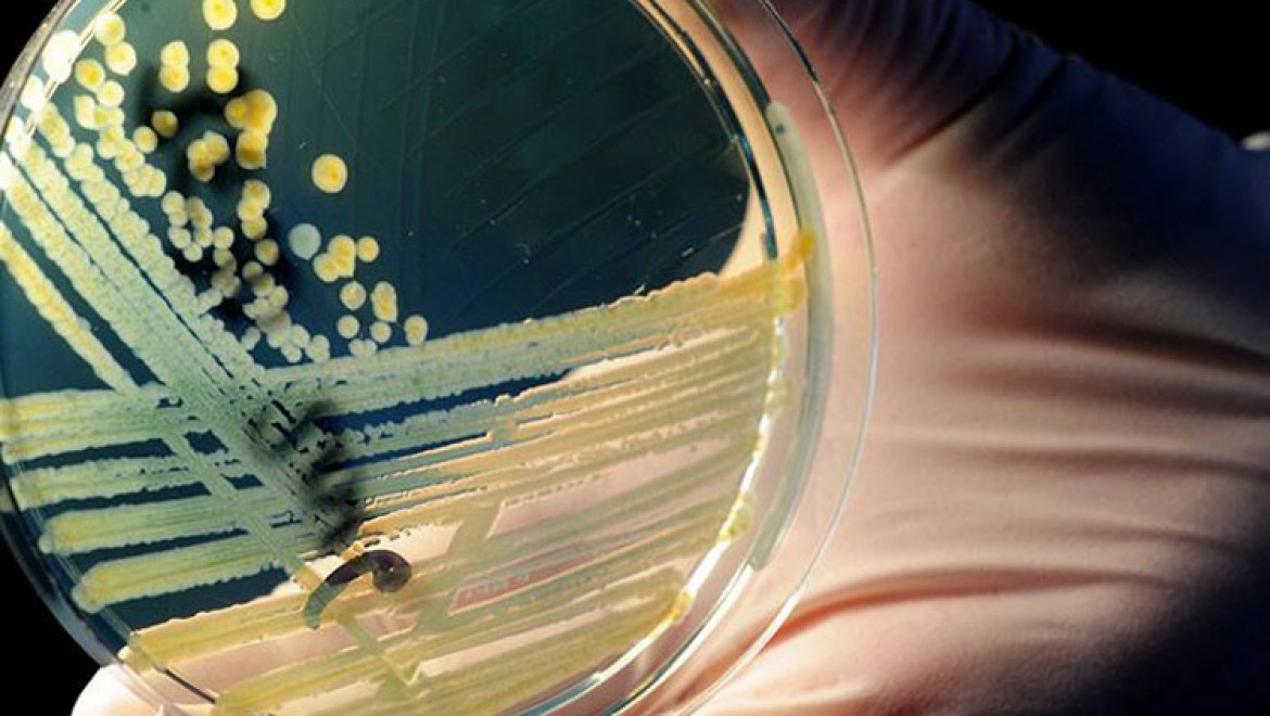 '2050'de antimikrobiyal direnç her yıl 10 milyon can alabilir'