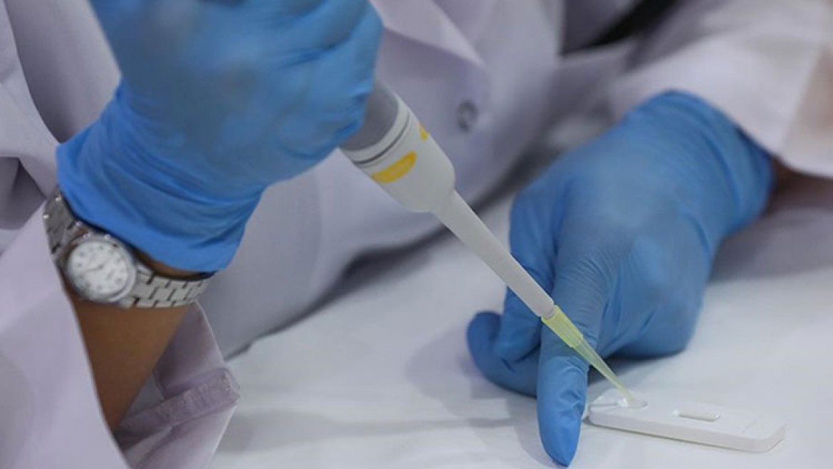 Mikrobiyologlar uyarıyor: Aşı sonrası antikor testine güvenerek tedbirleri elden bırakmayın