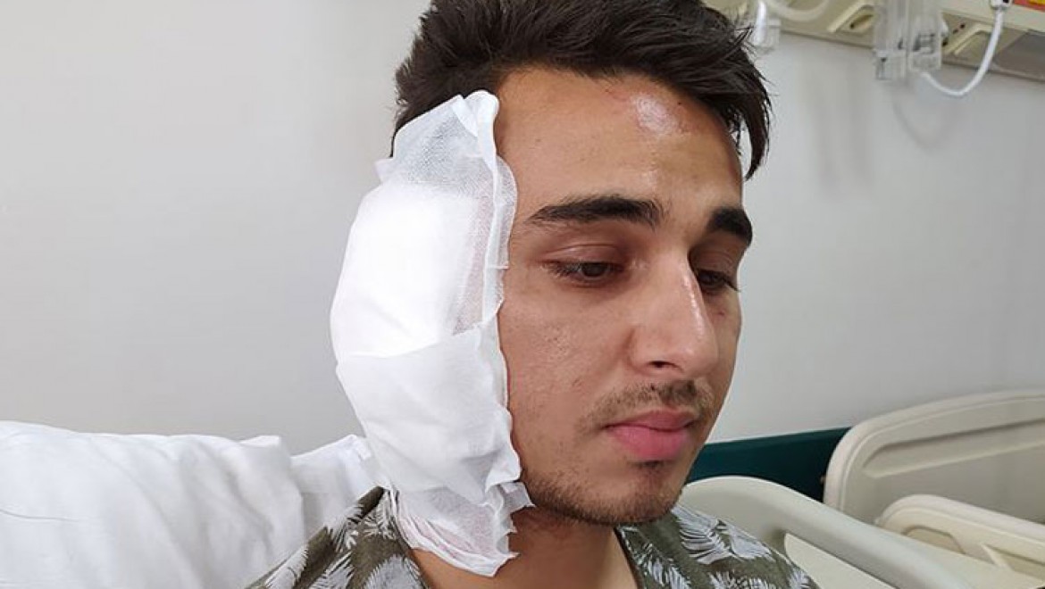 Karaman'da postacının kulağını ısırdığı iddia edilen şüpheli itiraz üzerine tutuklandı