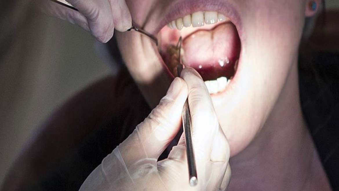 'Sigara diş eti hastalık riskini 4 kat artırıyor'